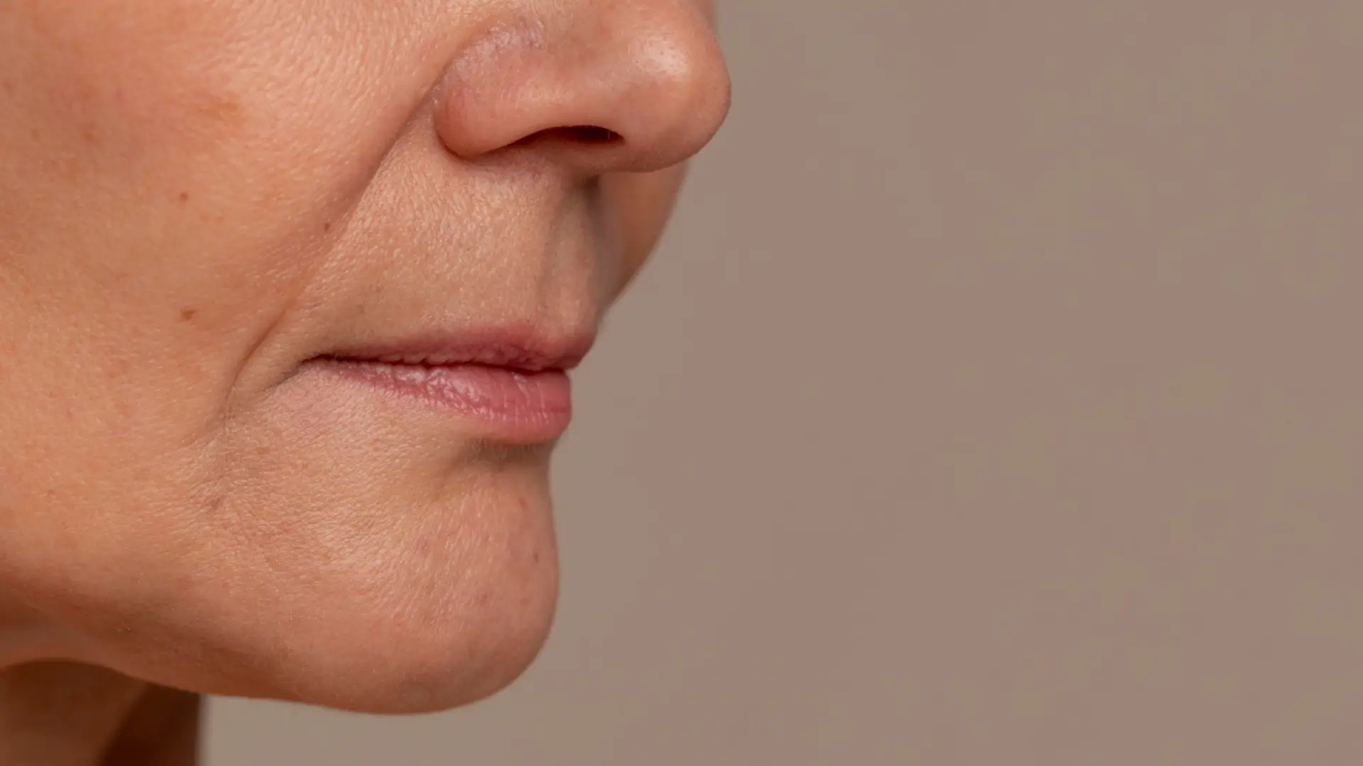An individual dealing with marionette lines and nasolabial folds.