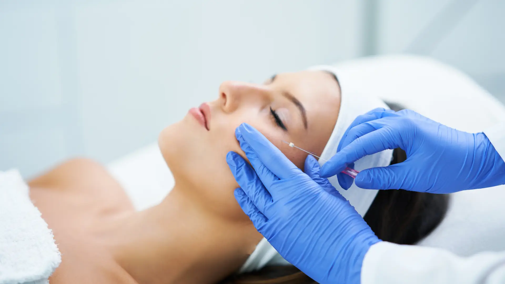 A patient undergoing a thread lift procedure.
