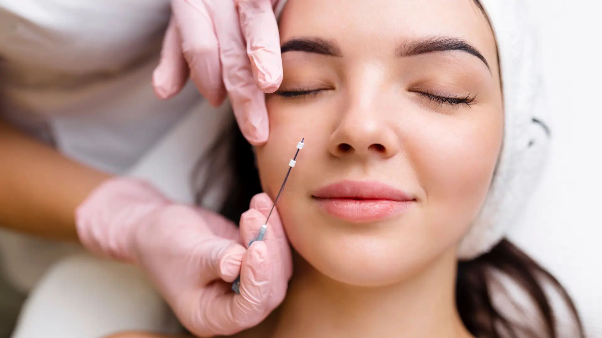 An individual receiving a thread lift for their under eye region.