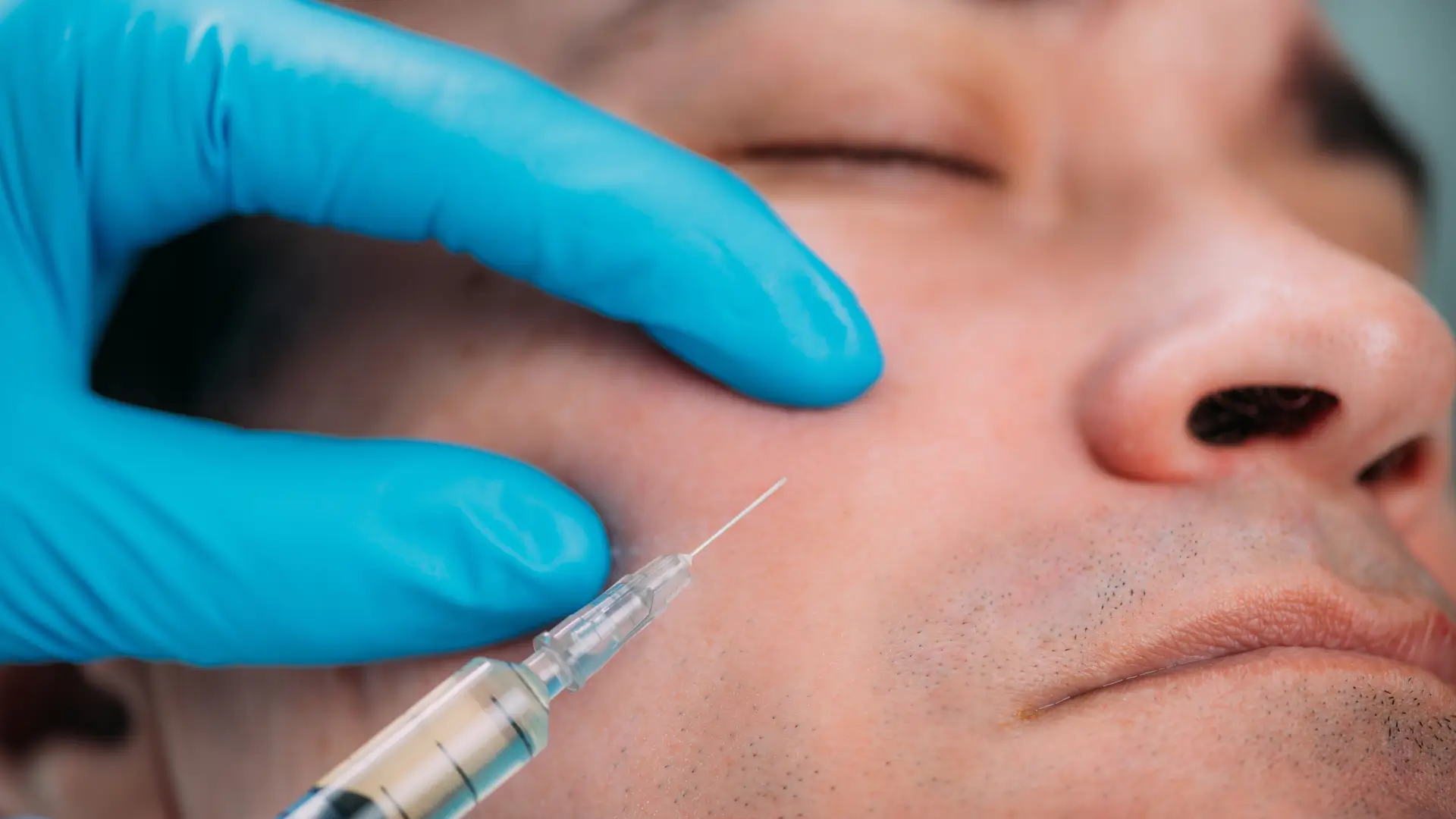 A medical professional administering an injection into a patient's midface region.