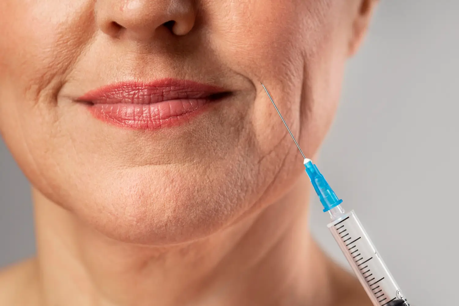 An elderly woman preparing for their nasolabial fold injection treatment.