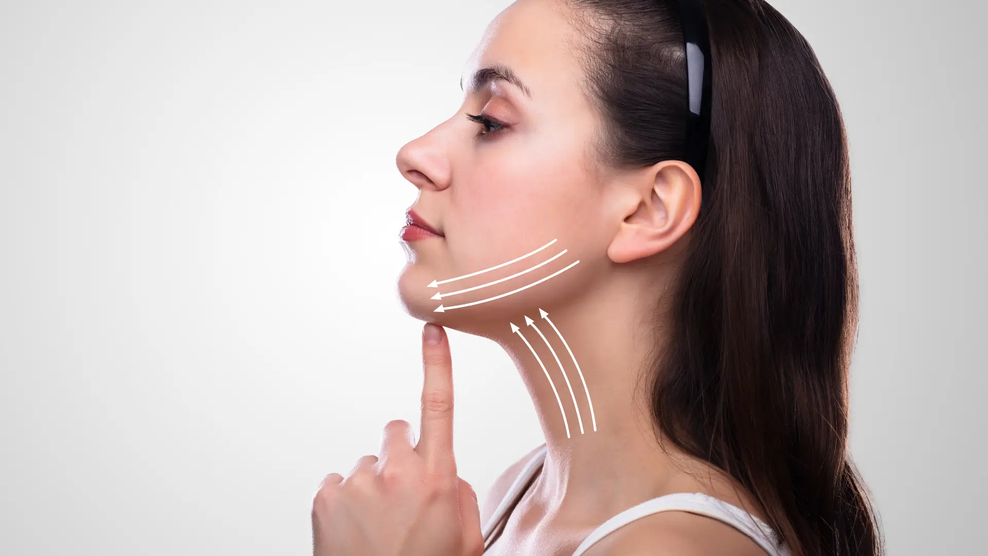 Marked areas of the neck that would require PDO thread lift treatment.