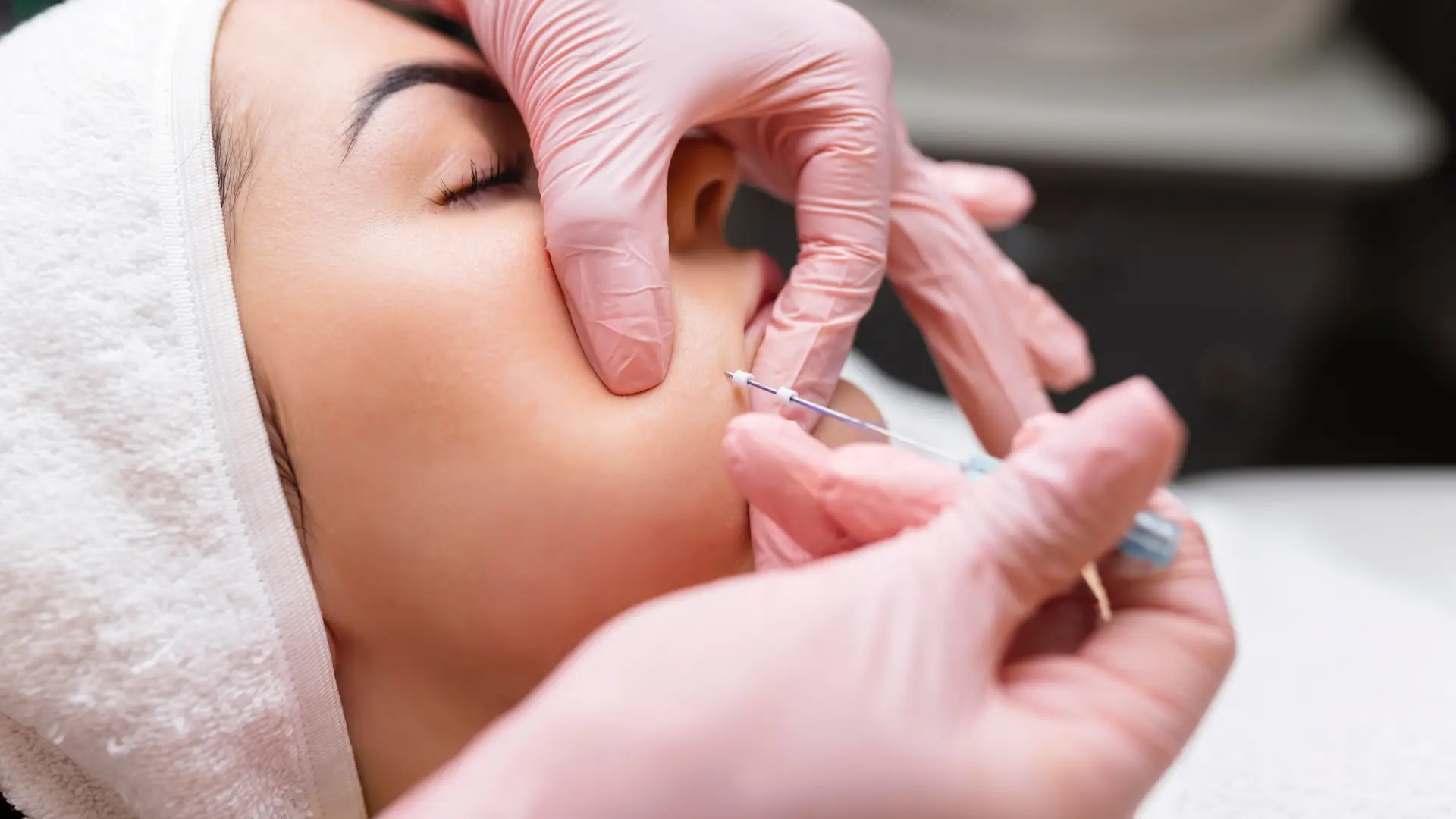 An individual undergoing a thread lift procedure.