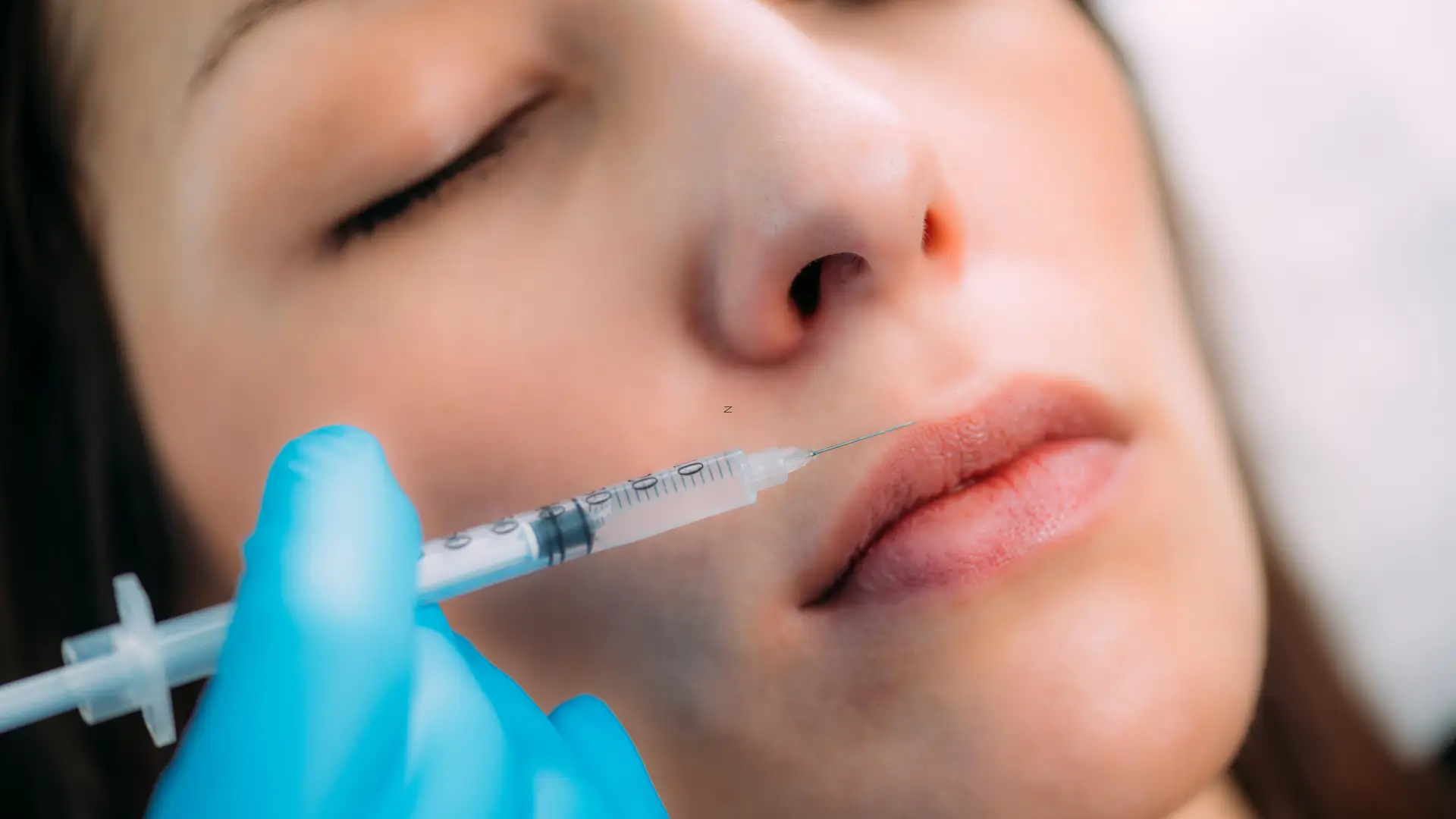A medical professional administering a dermal filler injection into a patient's lips.