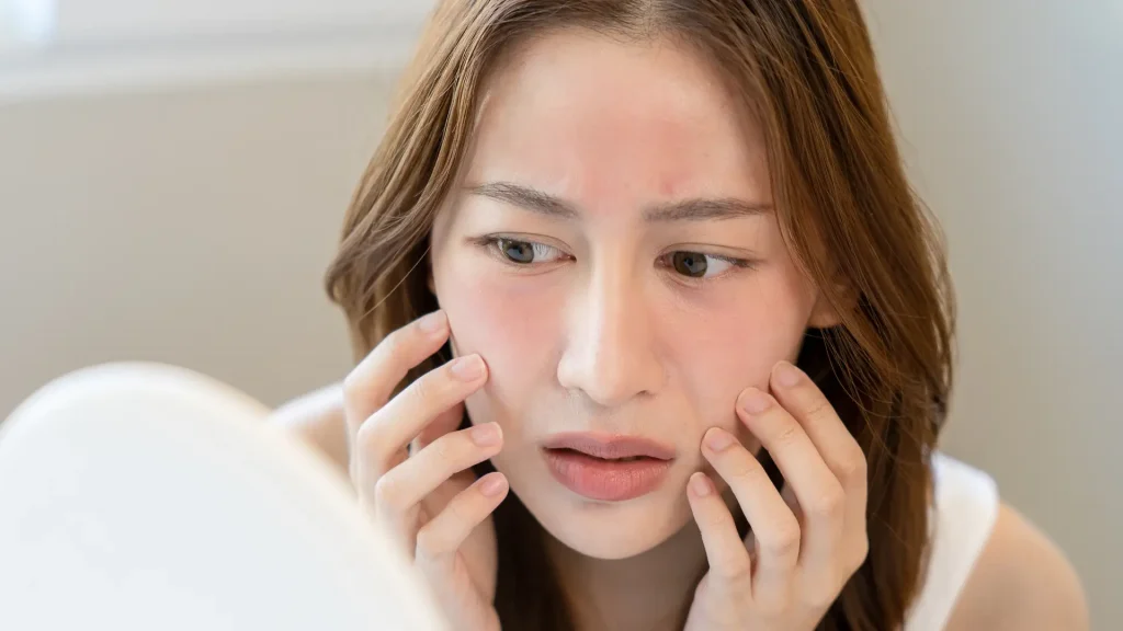 An individual suffering from redness in their facial region.