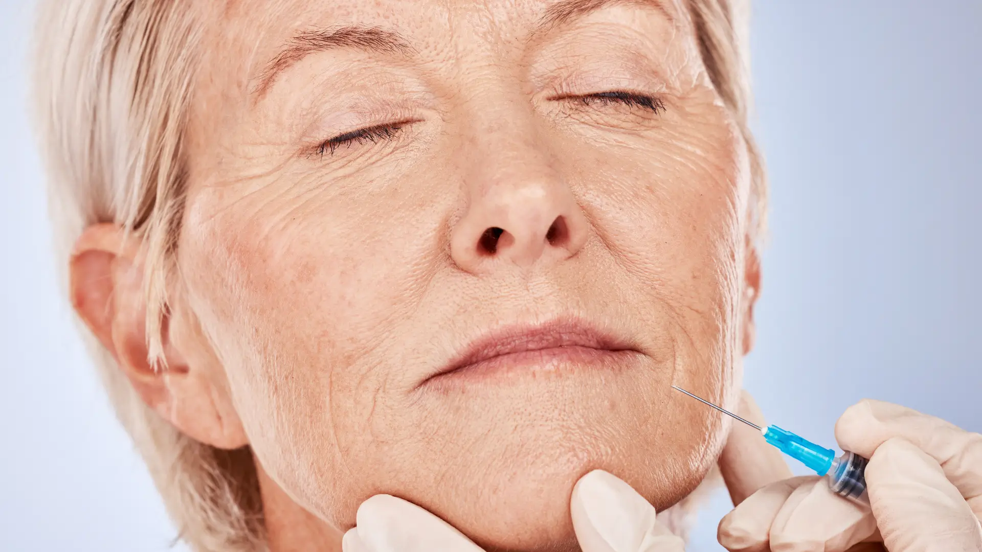 An older individual undergoing a nasolabial fold injection treatment.