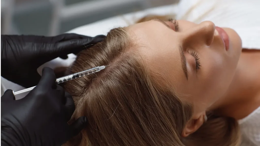 An individual receiving a hair mesotherapy injection into their scalp.