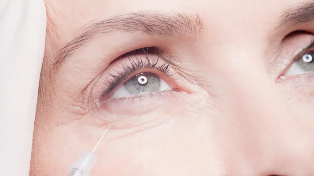 An individual receiving an injection for their under eye region.