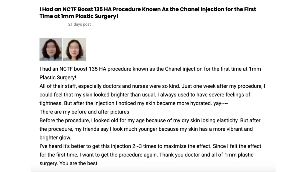 A patient's shared expereince of their NCTF 135 HA treatment for their face.