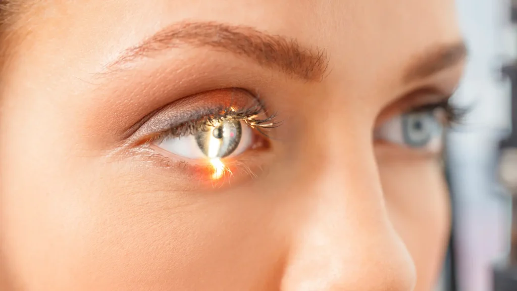 A patient undergoing an eye consultation.