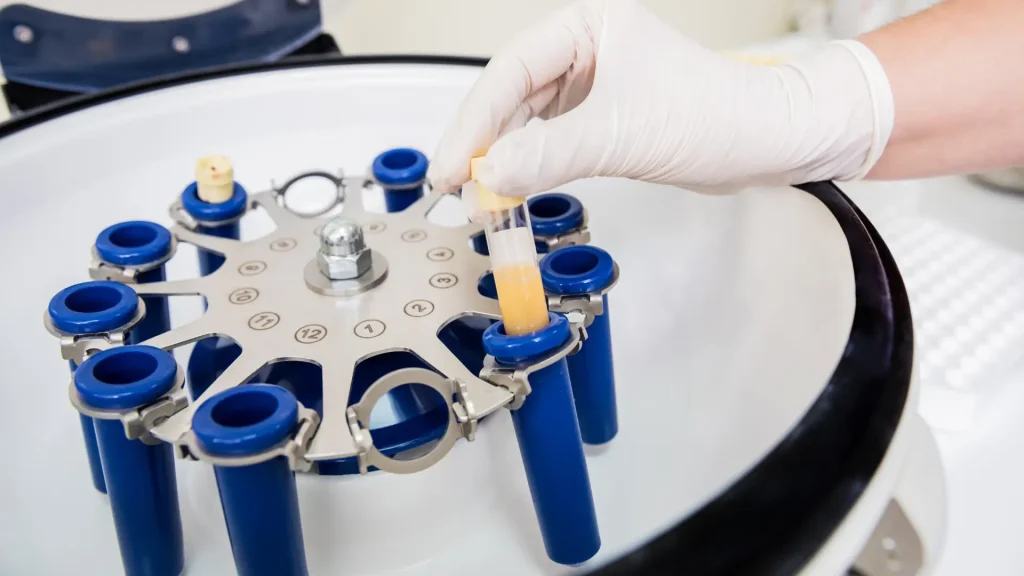 A medical professional preparing a PRP therapy.
