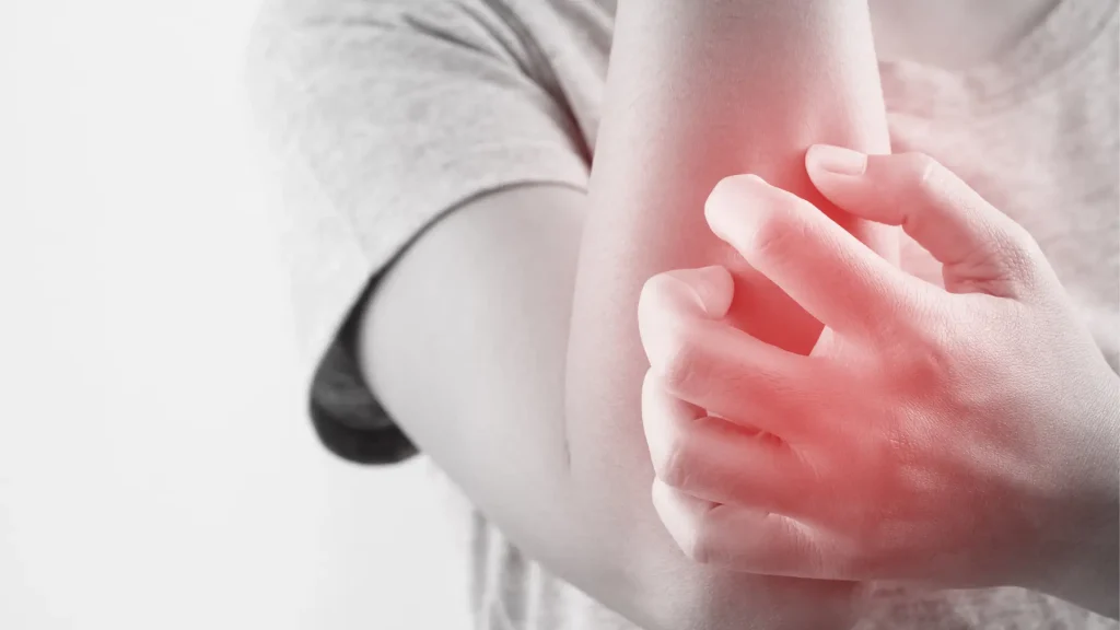 An individual dealing with itching on their arm.