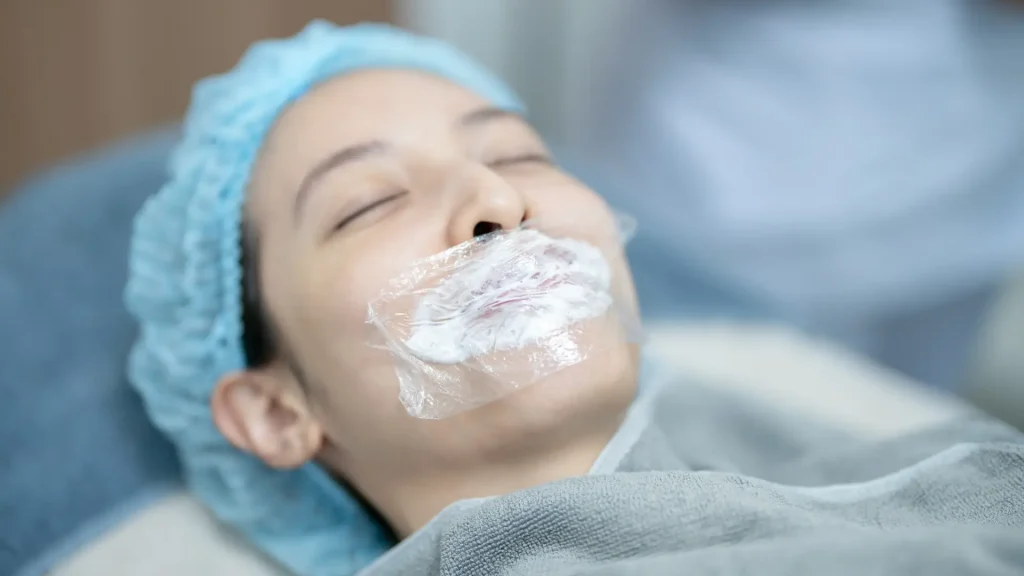 A patient undergoing an anesthetic process before their dermatological injection for lips.