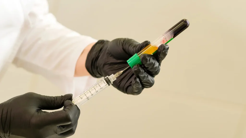 A medical professional preparing a PRP injection.
