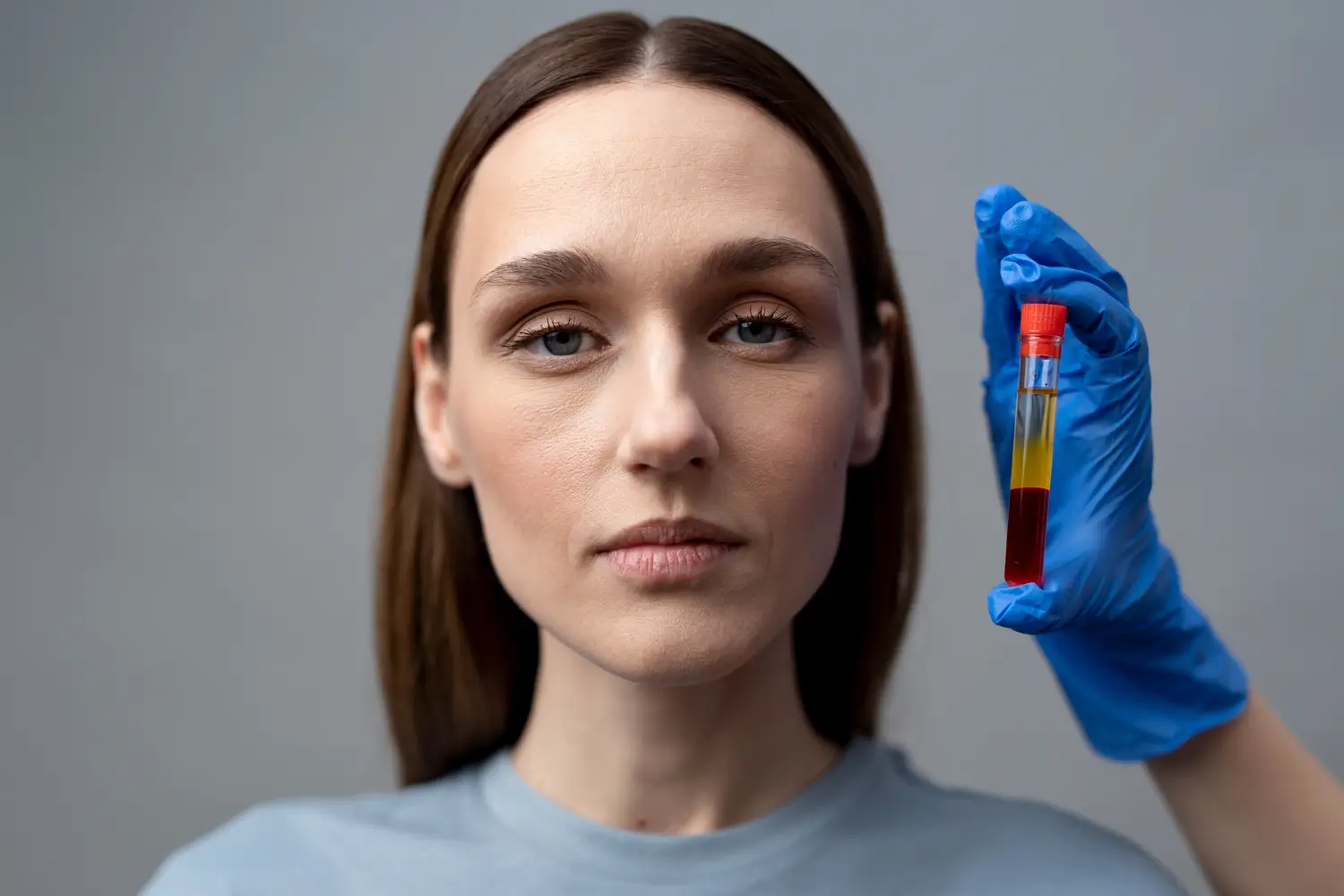 A patient's face next to a PRP vial.
