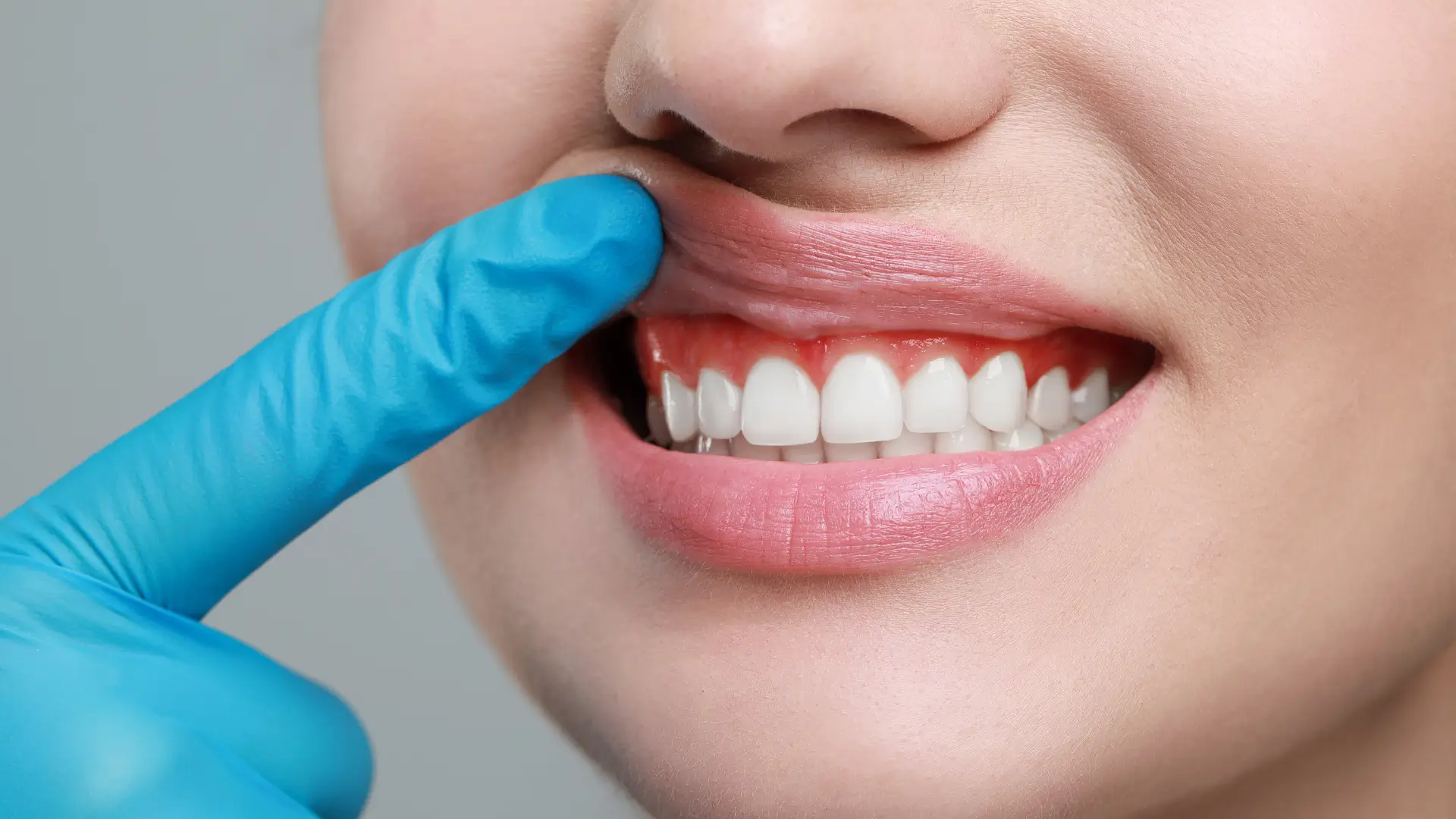 A medical professional showing off a patient's gums.