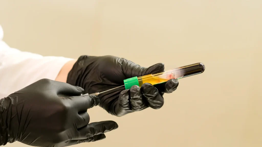 A medical professional preparing a PRP injection.