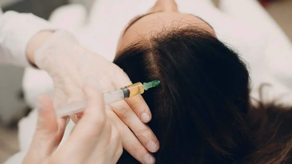 A medical professional administering a hair injection.
