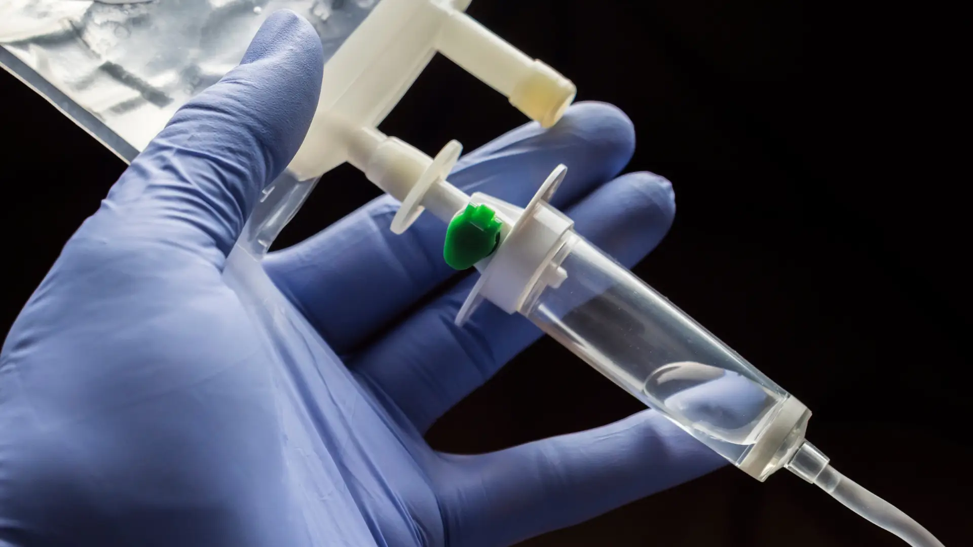 A close-up of a medical practitioners holding an intravenous (IV) infusion drip.