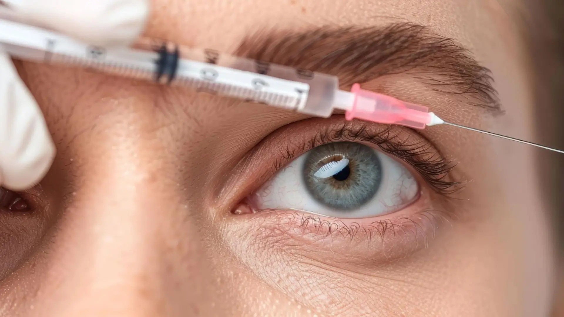 A patient's close-up shot of their eye before their injection treatment.