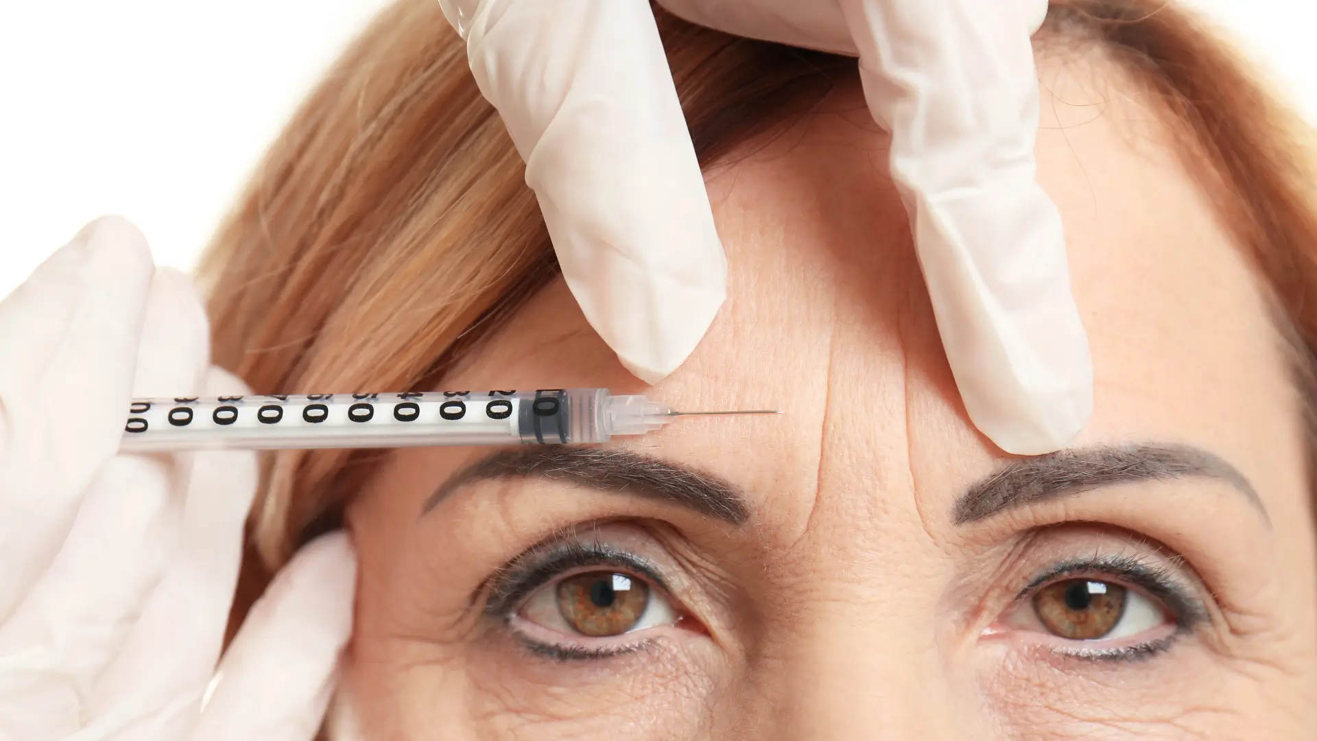 An individual receiving a botox injection for their frown lines.