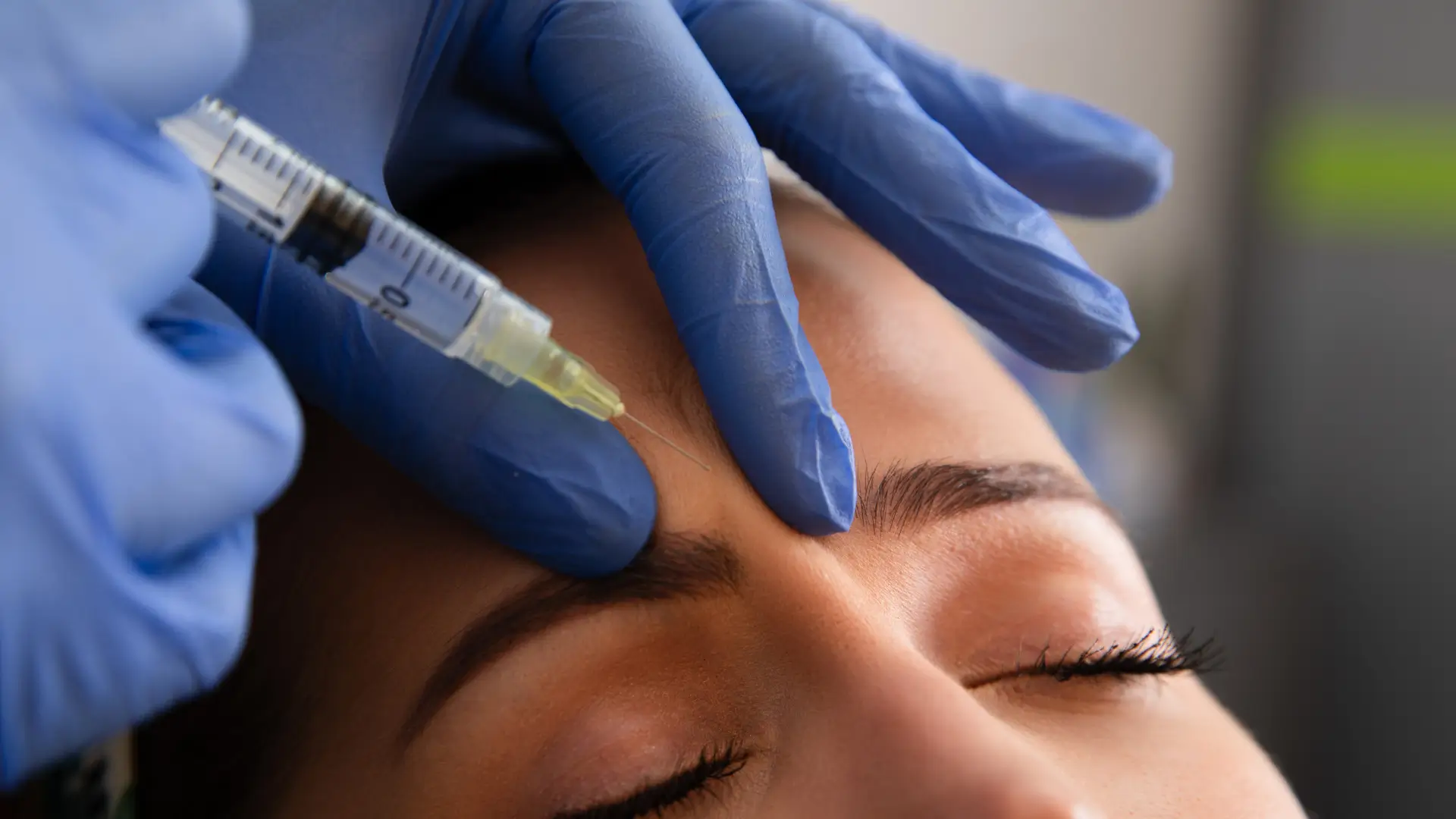 An individual receiving a botox injection for their frown lines.