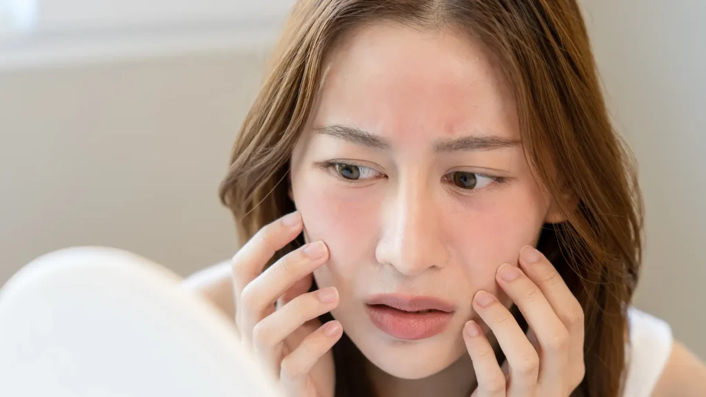 An individual dealing with facial redness.