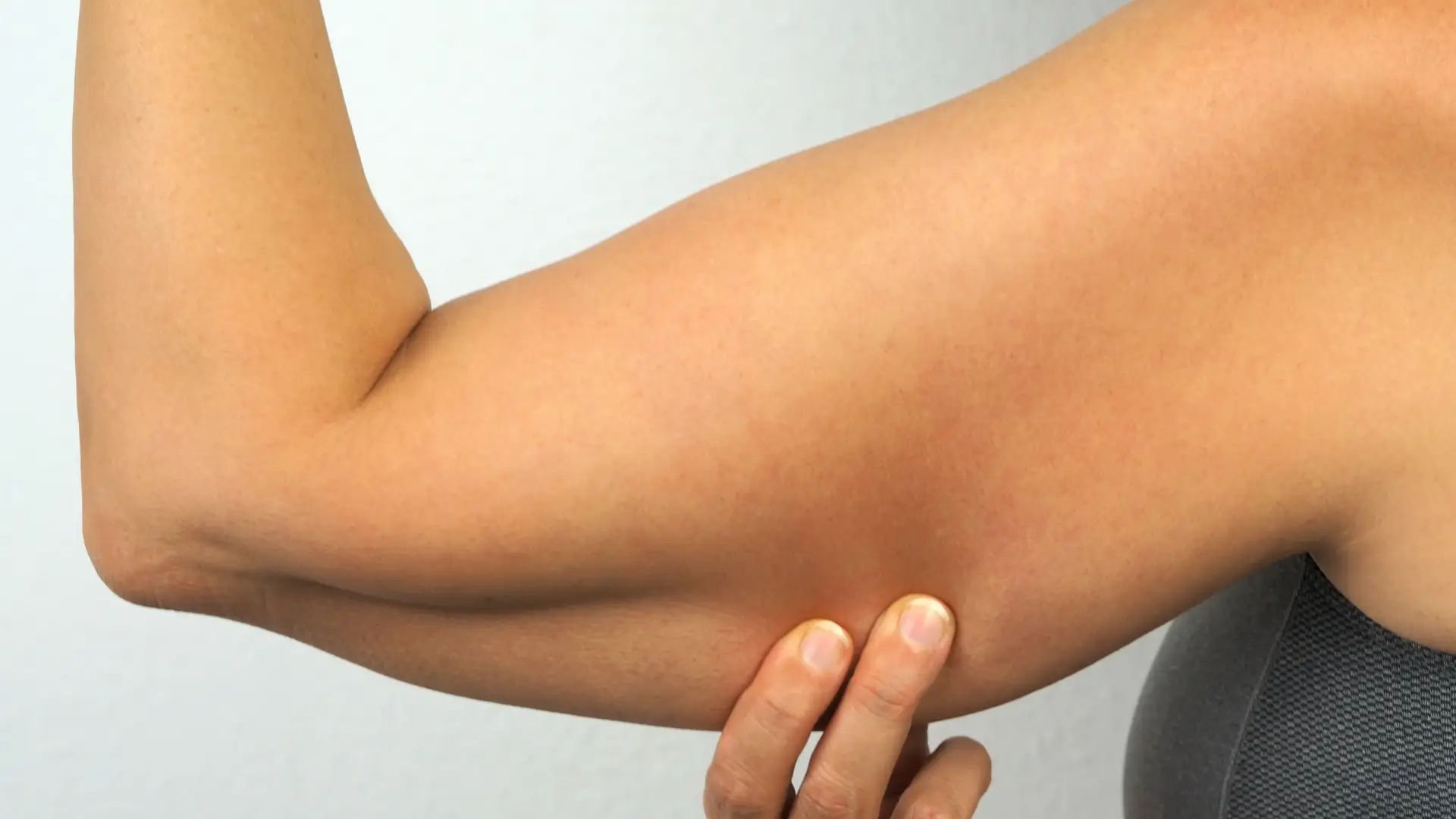 An individual dealing with excess fat on their upper arm.