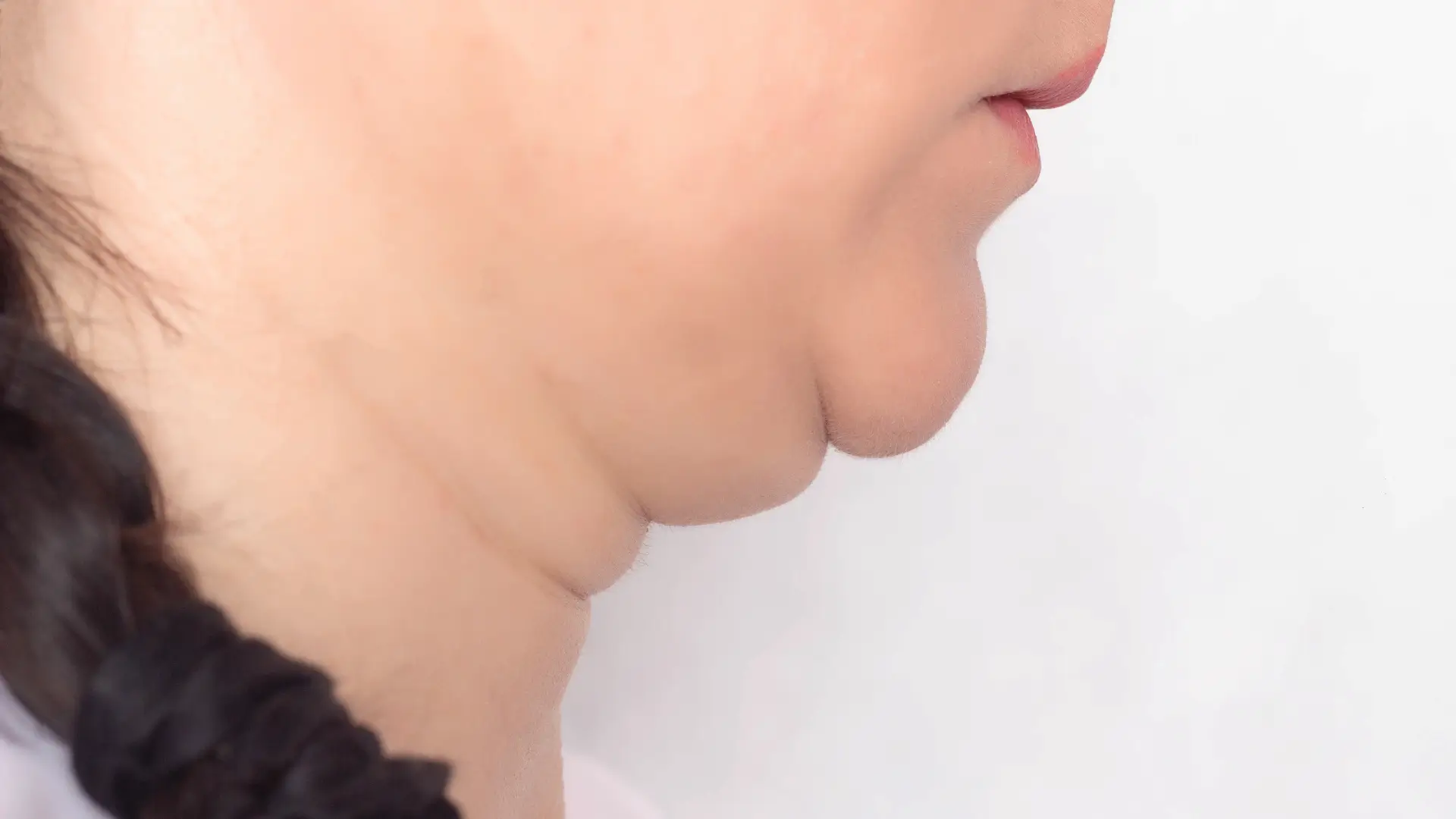 A close-up shot of an individual's double chin.