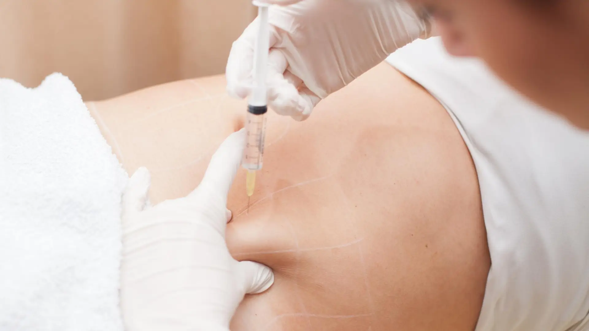 A medical professional administering a fat-reduction injection for a patient's abdomen.