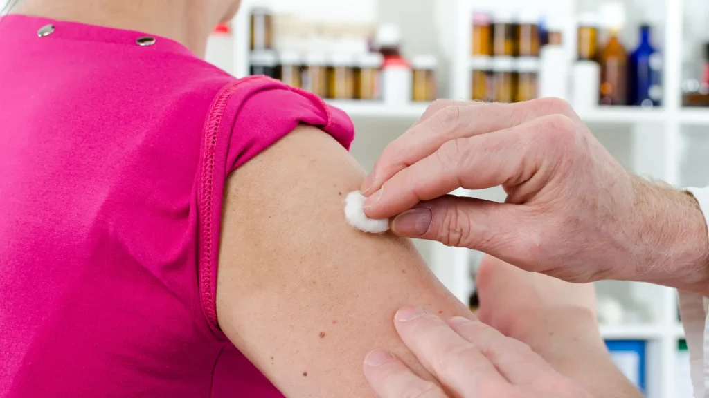 A medical professional cleansing the upper arm before administering an injection, similar on how to inject Mounjaro.