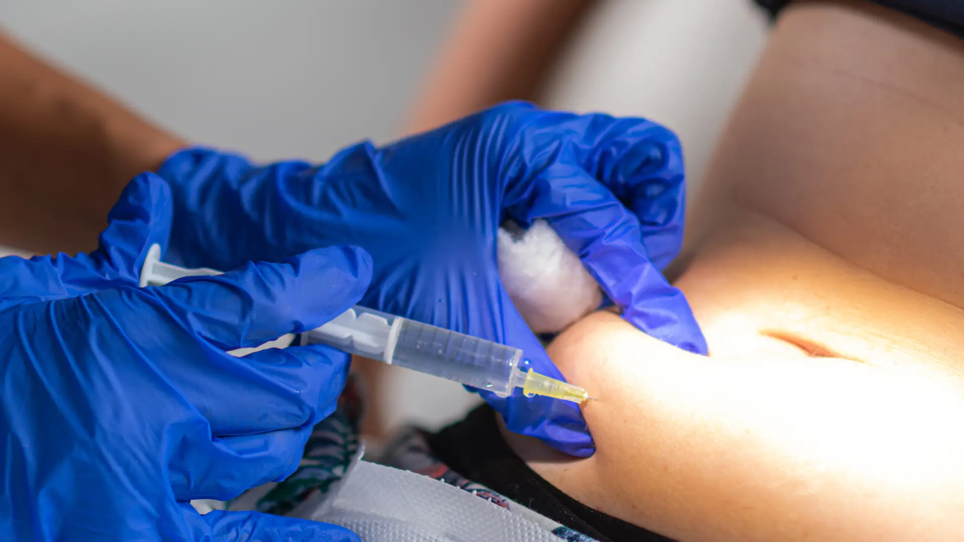 A healthcare professional administering proper Xolair dosing on the abdomen to achieve optimal outcomes of their patient.