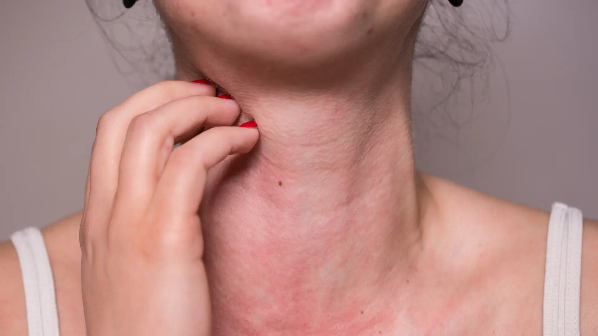 An individual dealing with itching on their neck, and possibly a symptom of an allergic reaction.