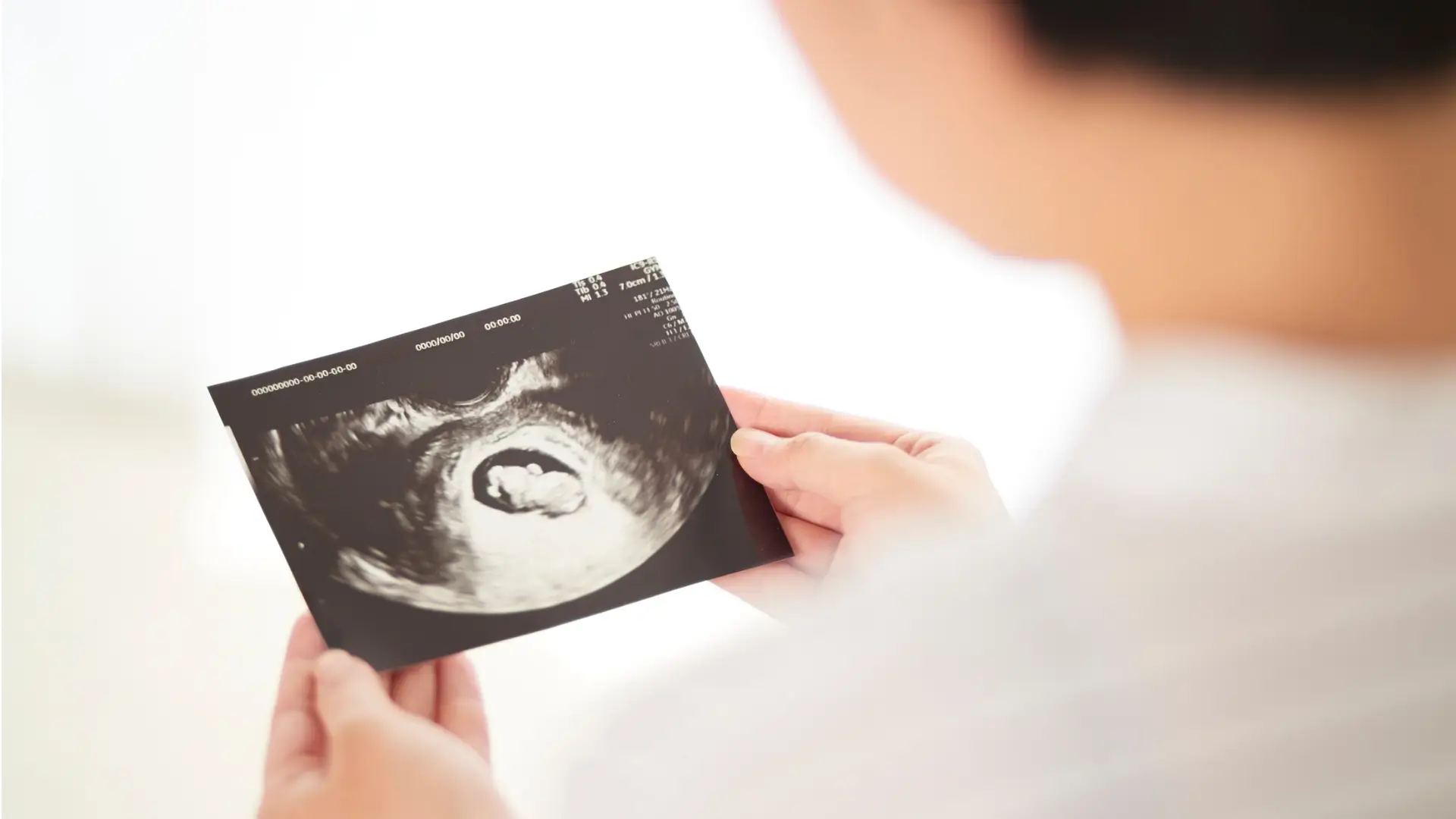 An expectant parent holding an ultrasound image.