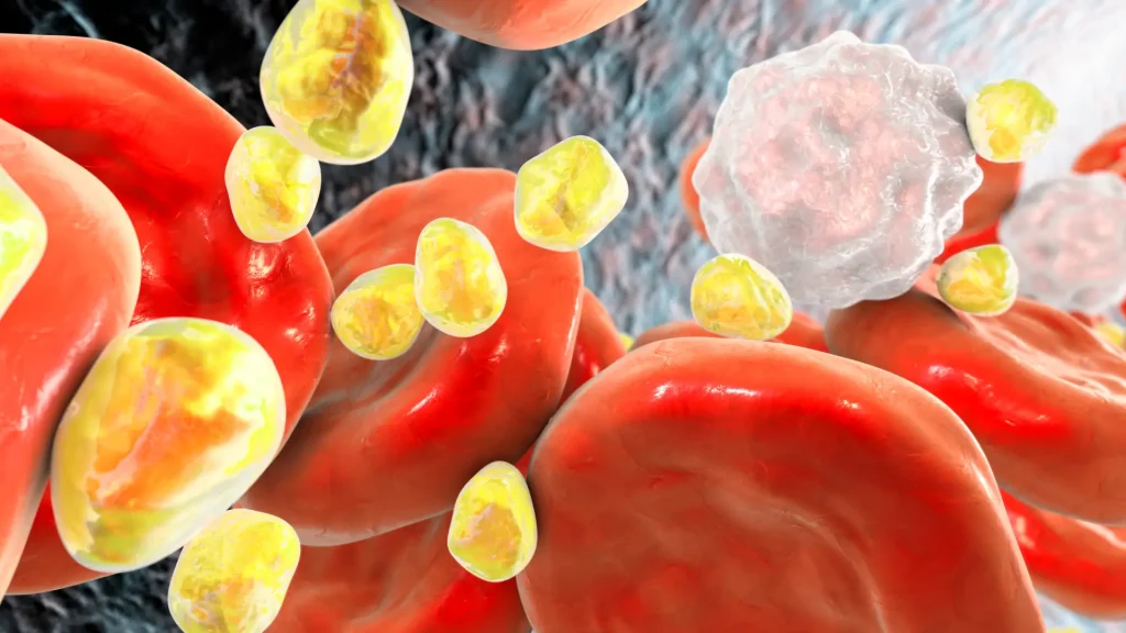 An illustration of high cholesterol levels before being treated clinically, potentially with retatrutide.