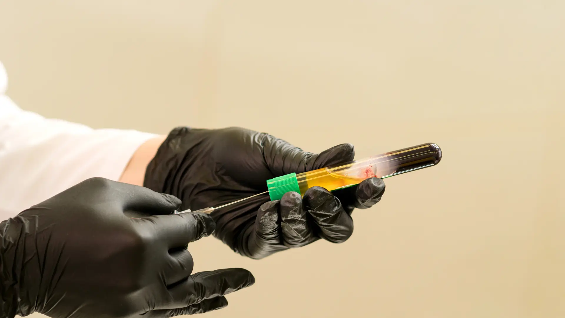 Orthopedic PRP Injections How They Work and Benefits.