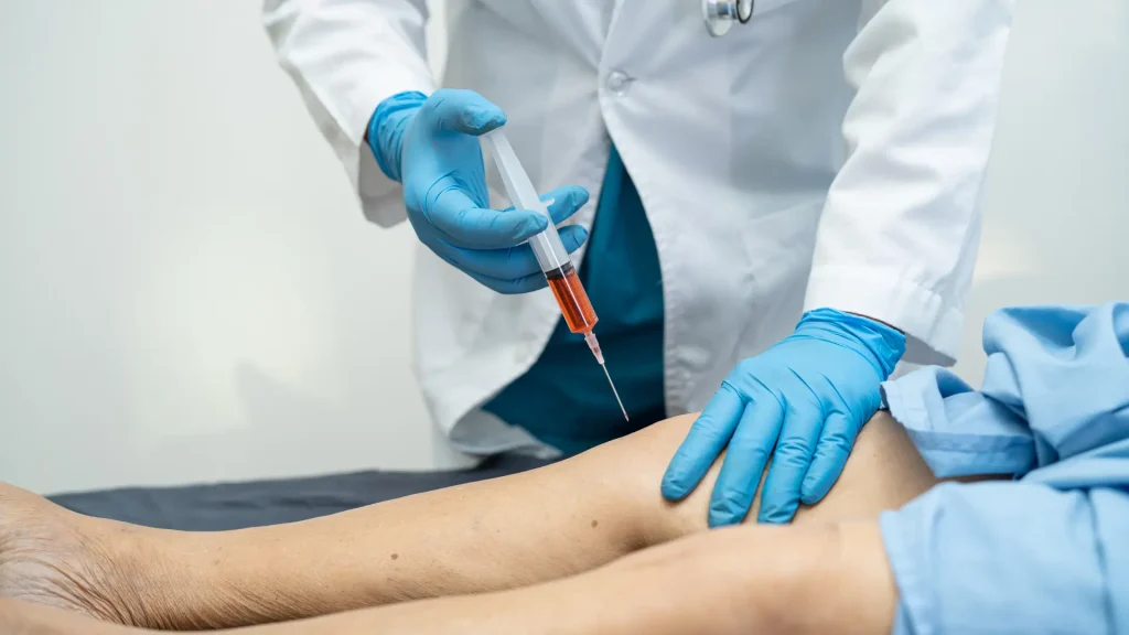 Orthopedic PRP Injections How They Work, Benefits & What to Expect.