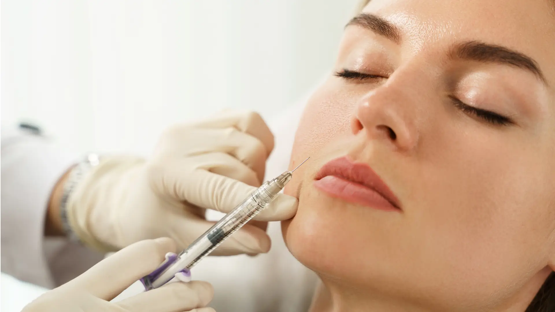 Biostimulators vs Dermal Fillers What's the Difference.