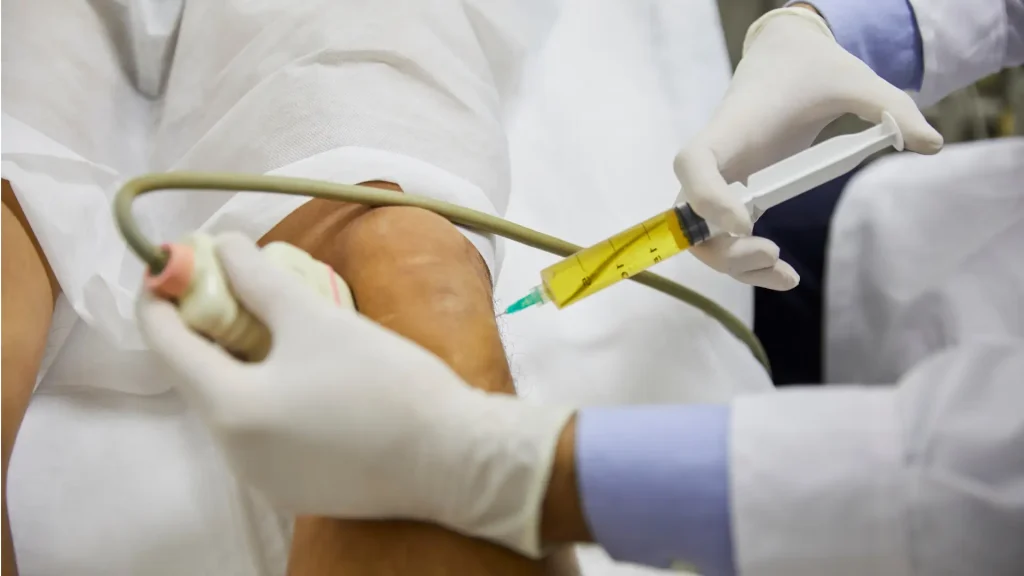 Orthopedic Stem Cell Injections Benefits, Risks & Current Evidence.